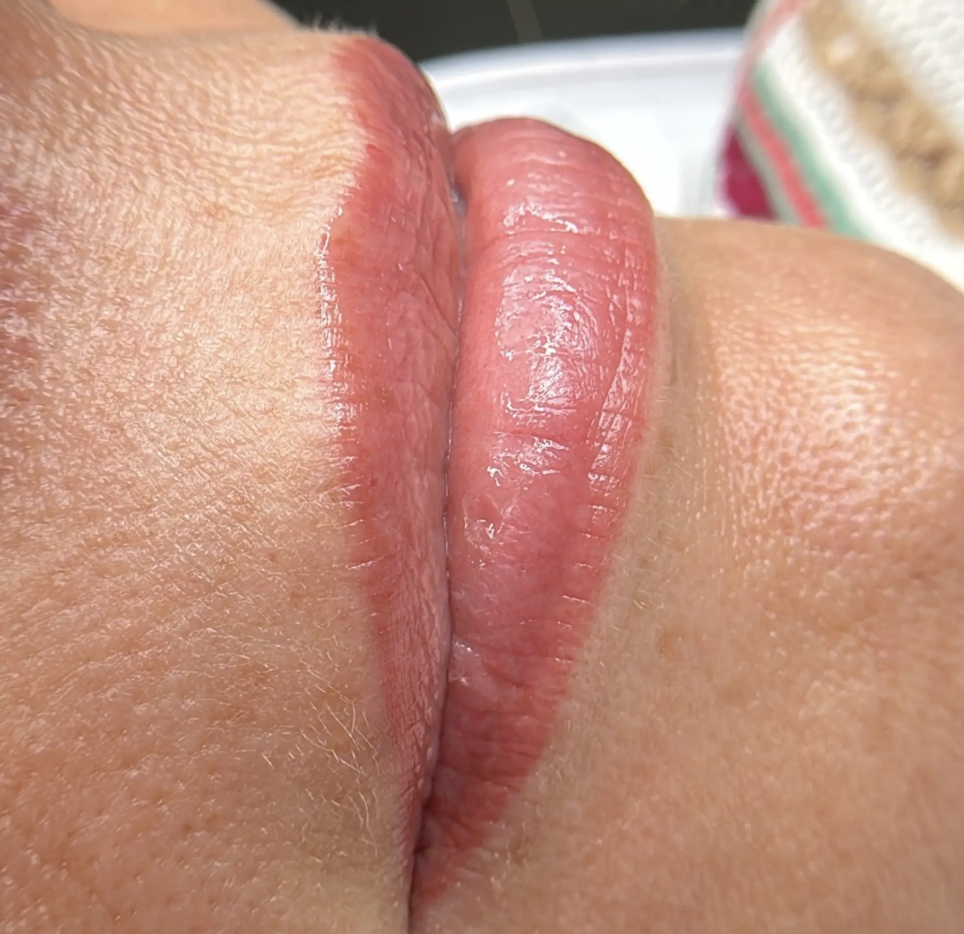 Healed lip blush