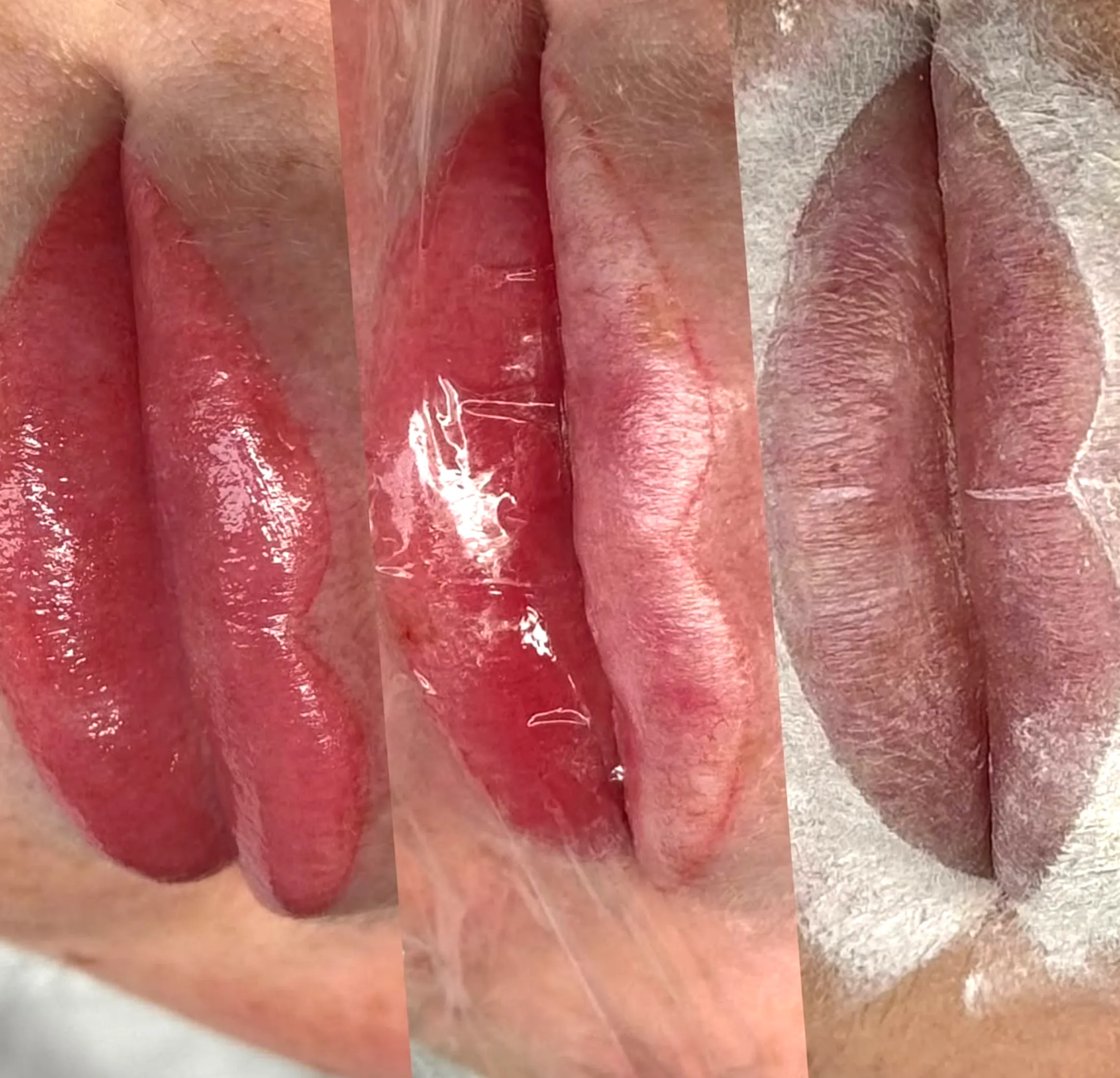 lip neutralisation tattoo