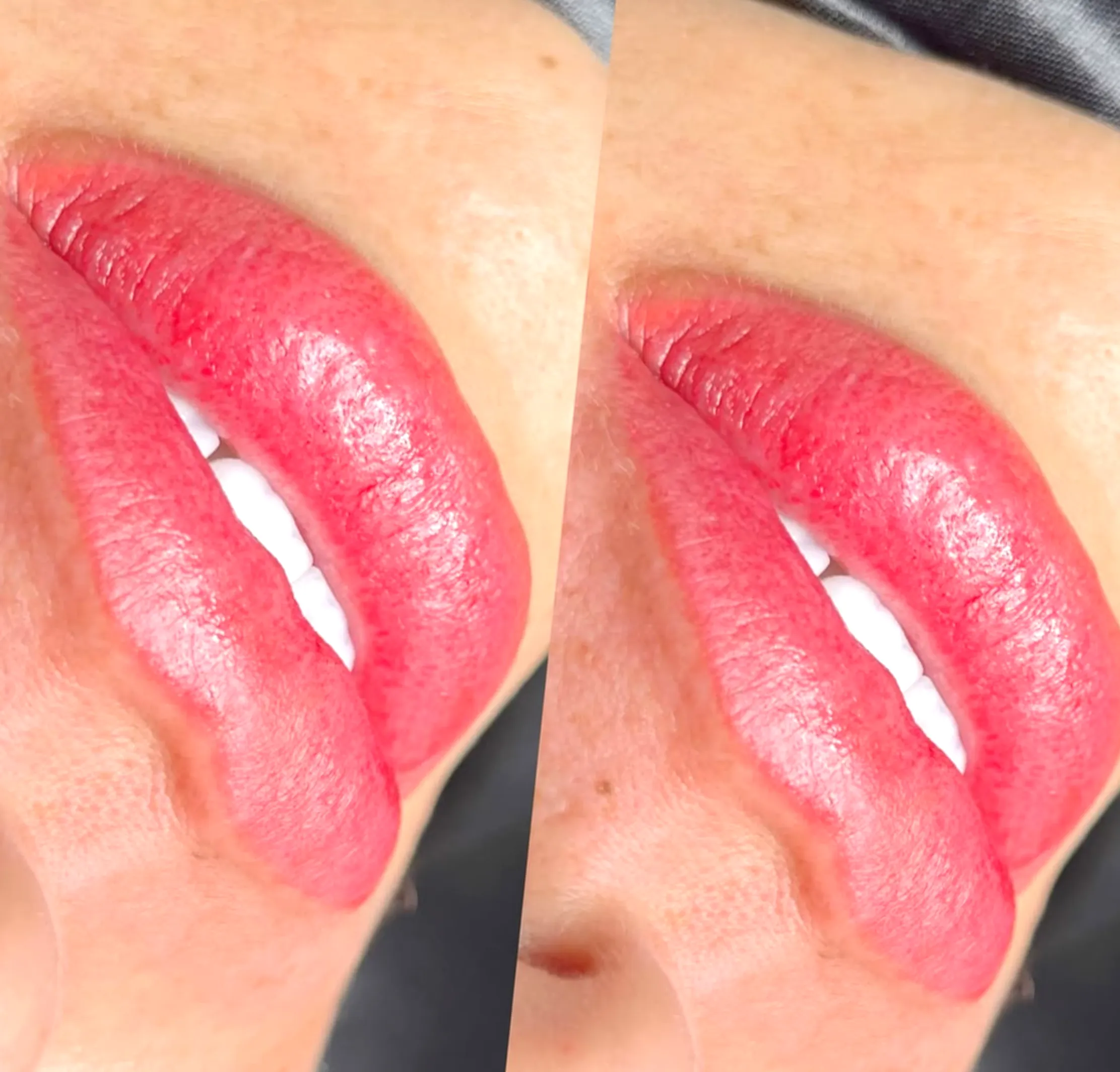 lip tattoo risks and complications