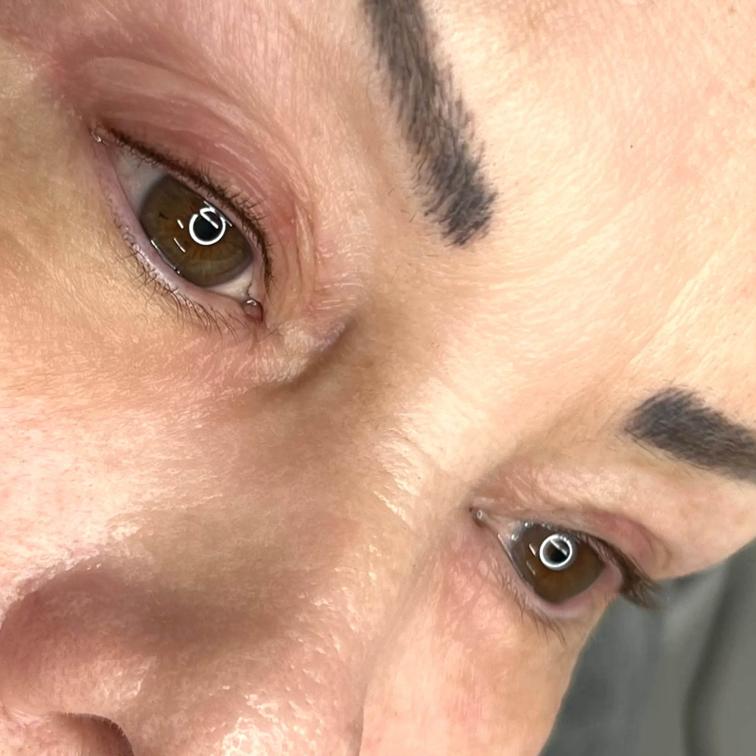 why remove eyeliner tattoo